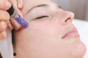 salmon-DNA-repair-Vamp-facial Los Angeles