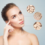 Diamond Glow for skin dryness