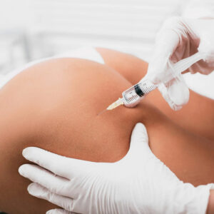 Sculptra Butt injection Los Angeles