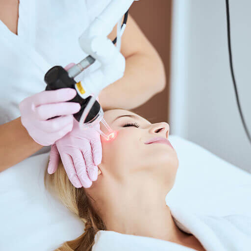 How does CO2 laser skin resurfacing work Los Angeles