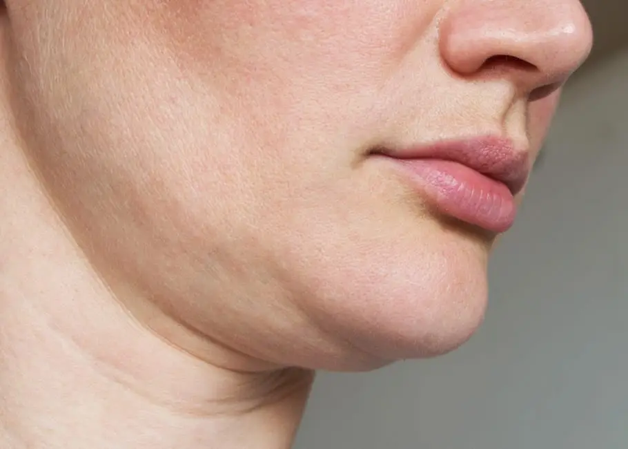 causes of skin laxity Los Angeles