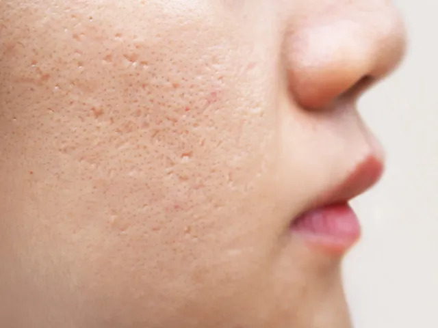 facial scars treatment Los Angeles