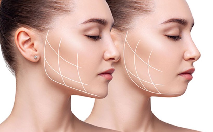 Sculpt your jawline and soothe jaw pain with Botox on masseter Los Angeles