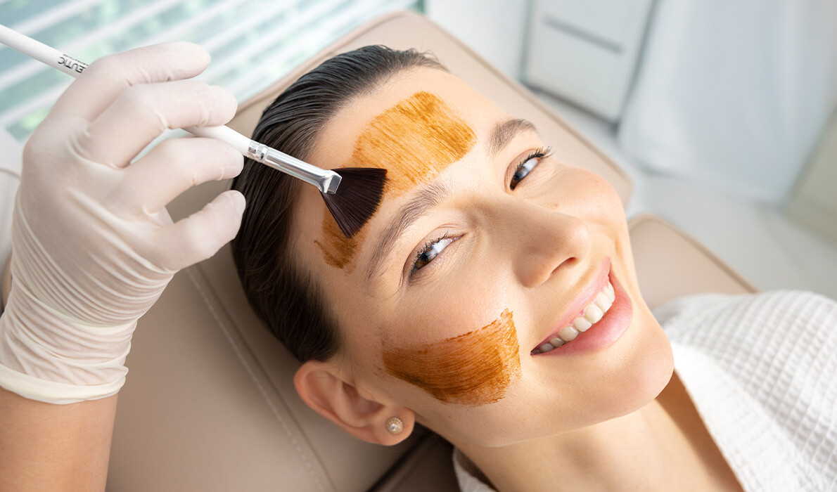 Cosmelan Peel for pigmentation Los Angeles