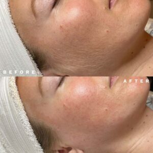 Diamond-Glow-before-after Los Angeles