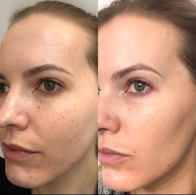 benefits of Diamond Glow for hydrate skin Los Angeles