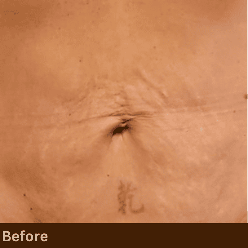 density rf before the treatment
