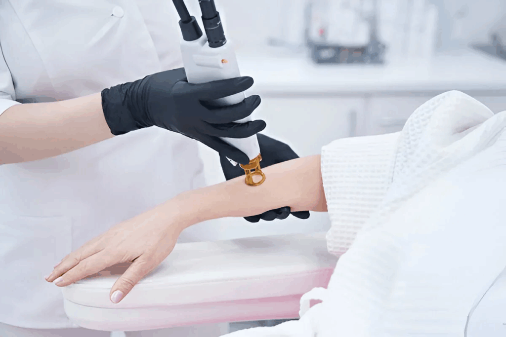 Areas that can be treated with Alexandrite laser hair removal Los Angeles