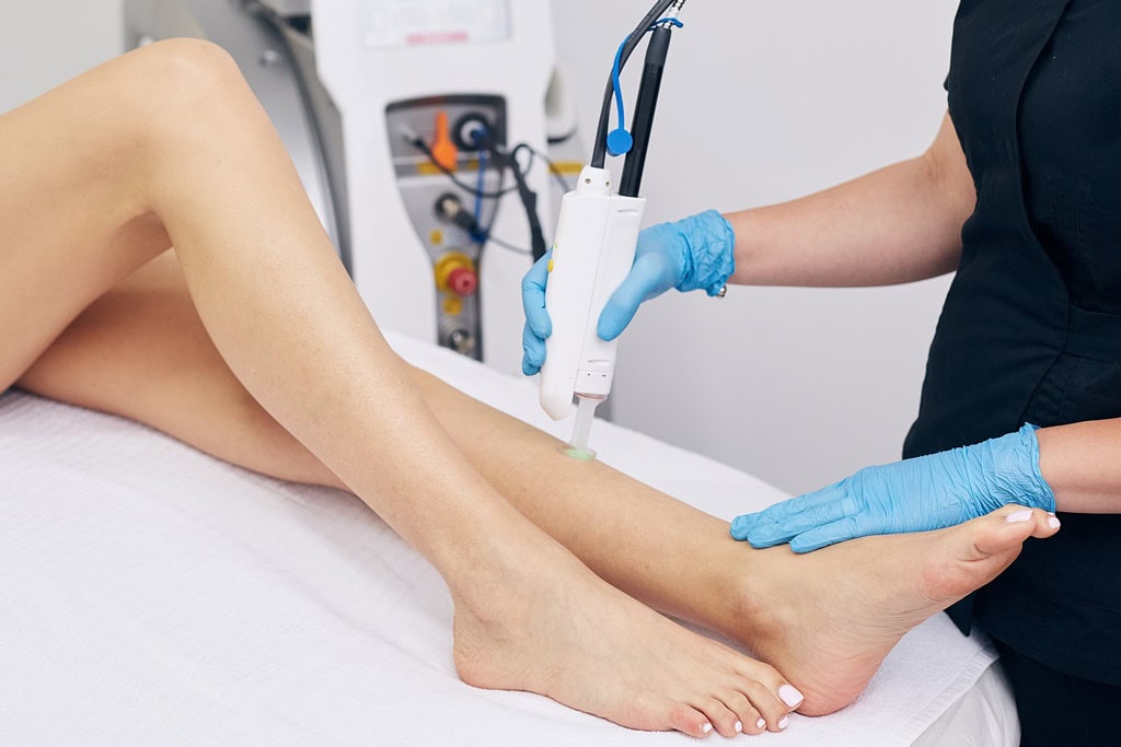 benefits of YAG laser hair removal Los Angeles