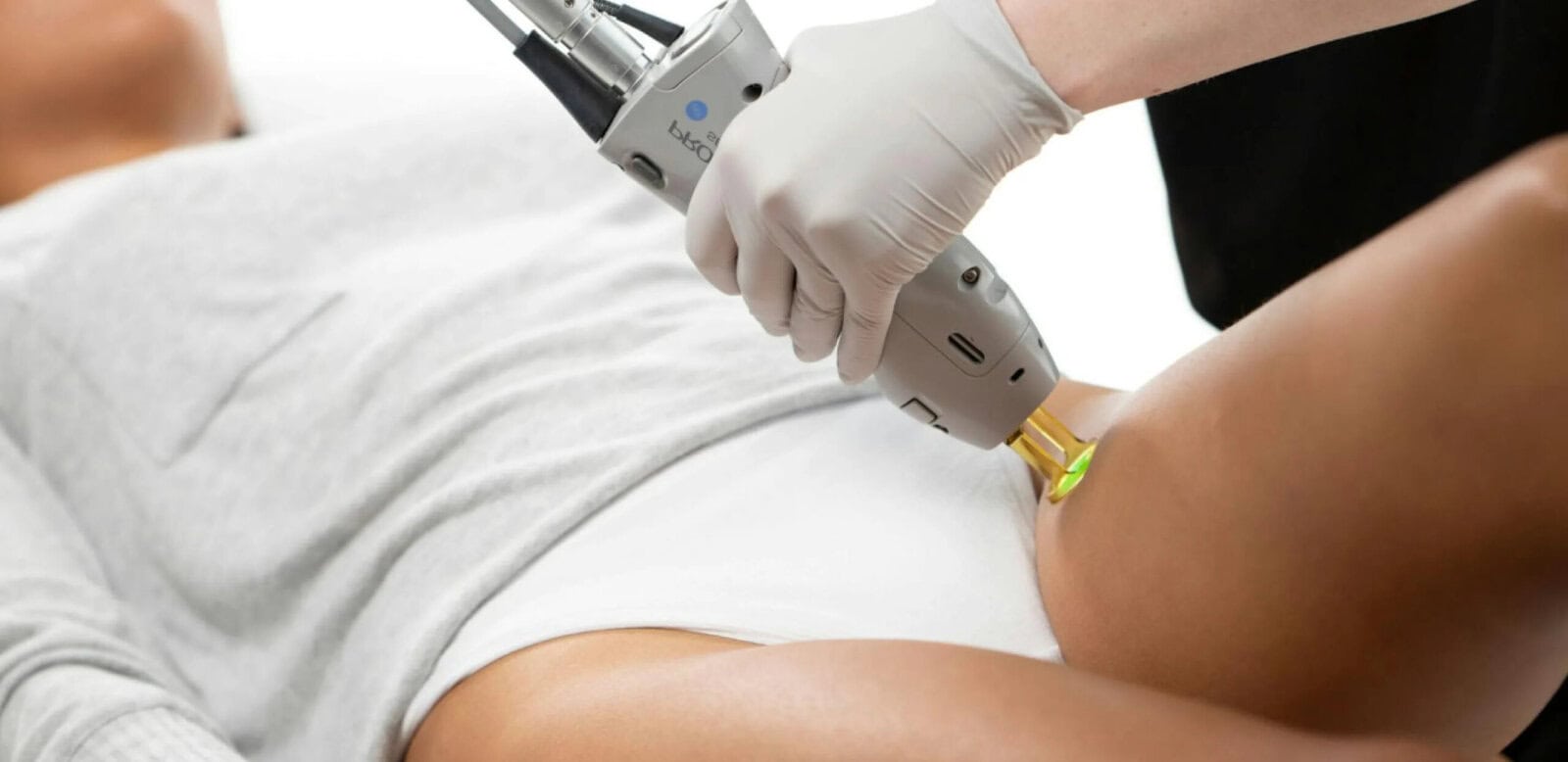 YAG laser for hair removal Los Angeles