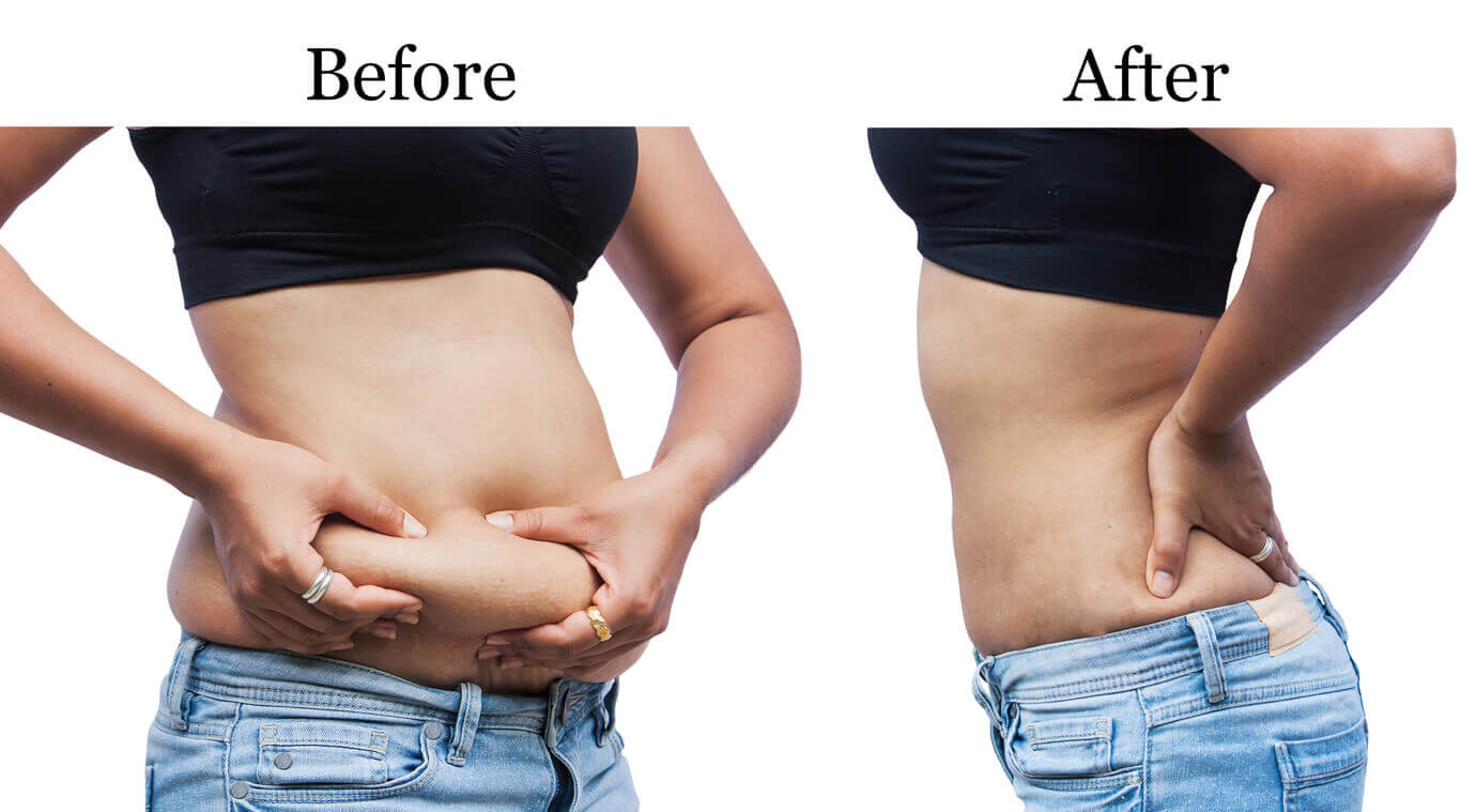 Tirzepatide weight loss injection: Supporting long-term weight goals - Hush LA Medspa Tirzepatide weight loss injection: Supporting long-term weight goals - Hush LA Medspa